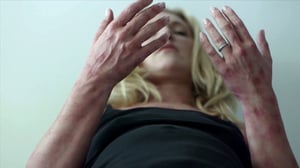 Monsters Inside Me, Season 7 Episode 4 image