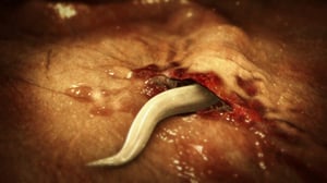 Monsters Inside Me, Season 7 Episode 5 image