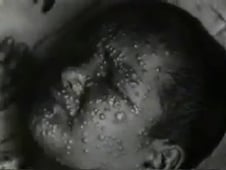 Horizon, Season 34 Episode 5 image