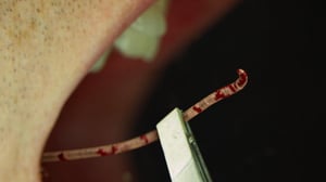 Monsters Inside Me, Season 8 Episode 4 image