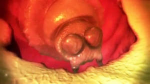 Monsters Inside Me, Season 2 Episode 7 image