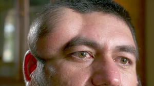 Dr. Pimple Popper, Season 2 Episode 7 image