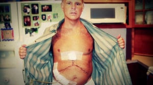 Monsters Inside Me, Season 2 Episode 2 image