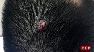 Dr. Pimple Popper, Season 1 Episode 3 image