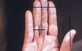 The Six Million Dollar Man, Season 3 Episode 13 image