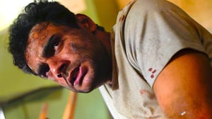 Transplant, Season 1 Episode 1 image