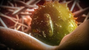 Monsters Inside Me, Season 5 Episode 2 image